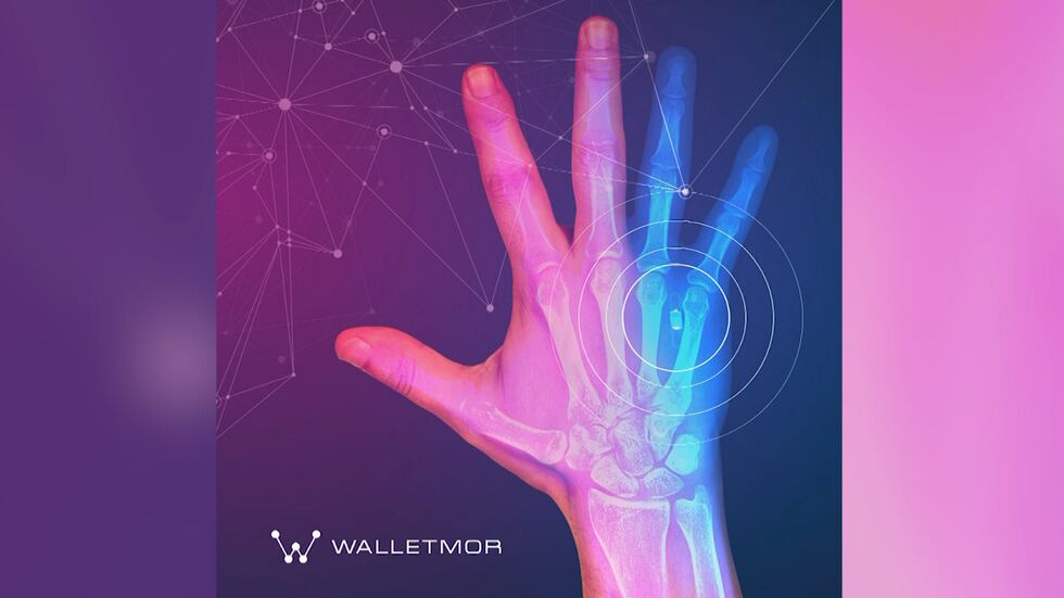 The British-Polish company, Walletmor, is selling microchips as alternative payment options.