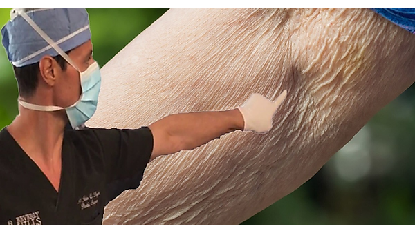 The 1 Household Item That Visibly Tightens Saggy Skin The 1 Household Item That Visibly Tightens Saggy Skin